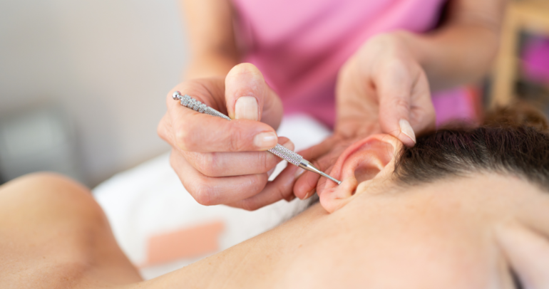 ¿Qué es la Auriculoterapia? Técnicas y beneficios para la salud
