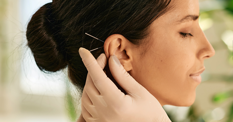 ¿Qué es la acupuntura auricular? Beneficios y técnicas